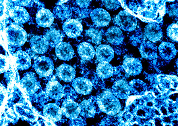 Il virus fantasma: alla ricerca del Sars-CoV-2