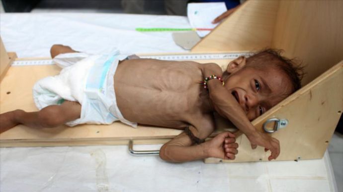 Yemen, disastro saudita e dell’occidente. Cinque milioni di persone sull’orlo della carestia