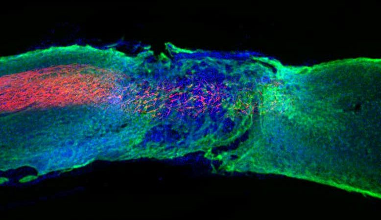 Un sorprendente gel inverte la paralisi di topi con lesioni al midollo spinale