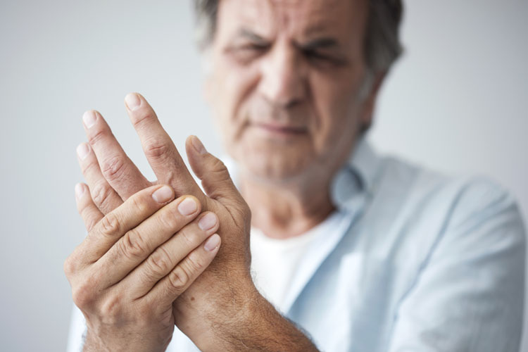 Curcuma, Boswellia e Vitamina D per l’osteoartrosi della mano