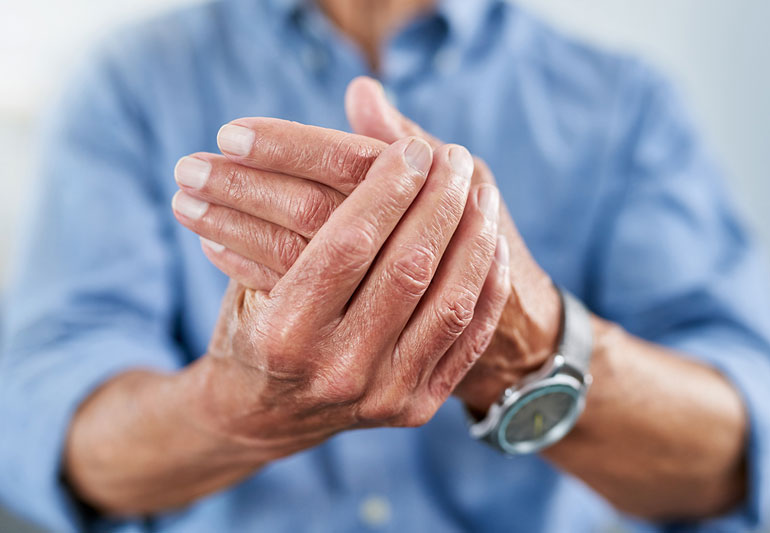 Curcuma, Boswellia e Vitamina D per l'osteoartrosi della mano